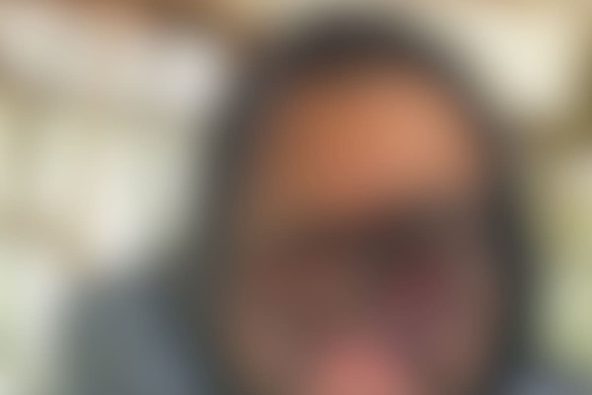 Piden ayuda para que José pueda sanar su rostro