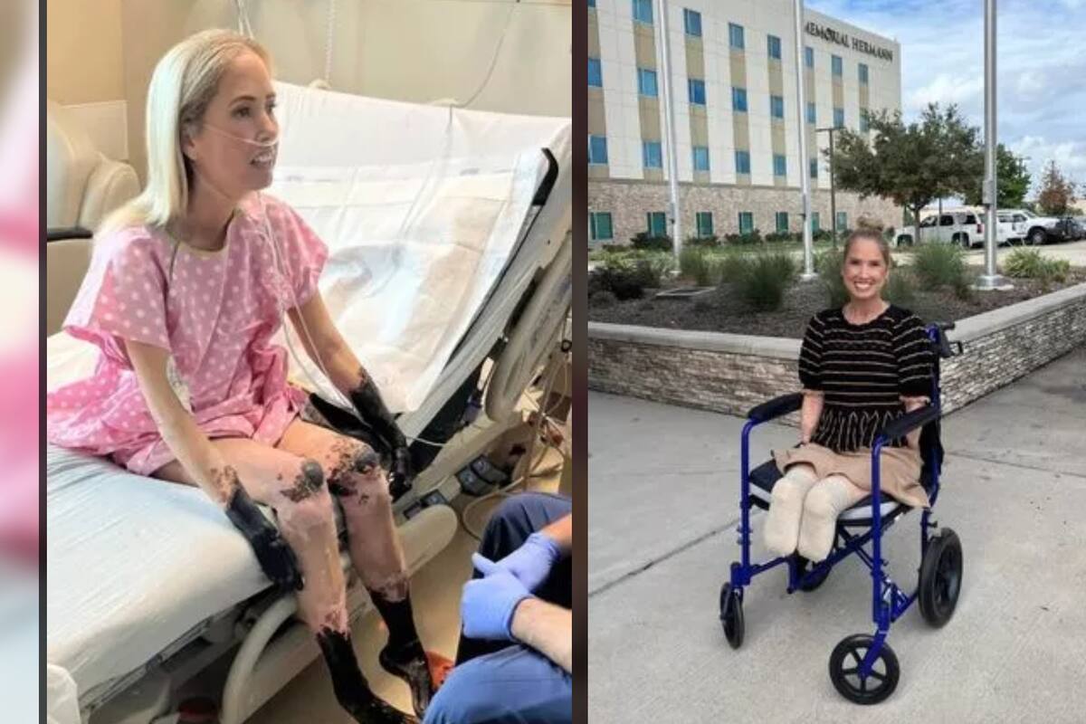 Maestra de Texas creía que tenía resfriado, pero acabó con sus extremidades momificadas y amputadas por una infección