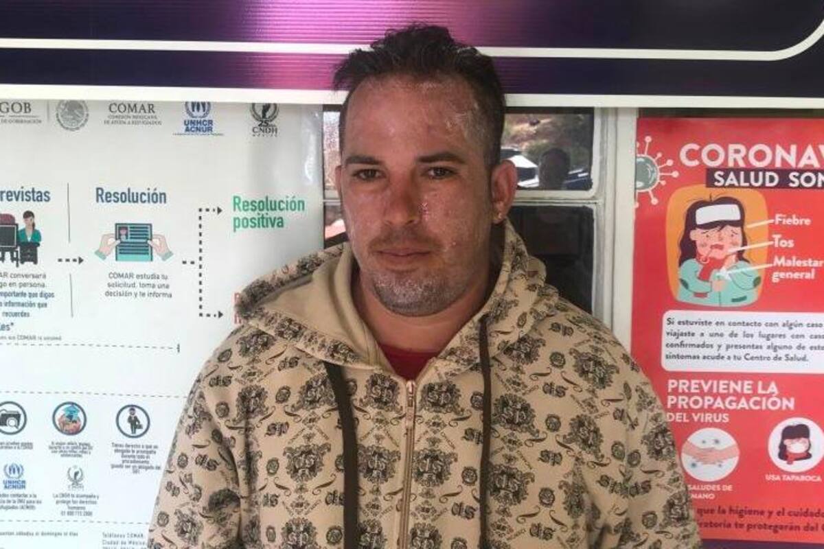 Registran 25 contagios de varicela en un mes en albergue de Nogales