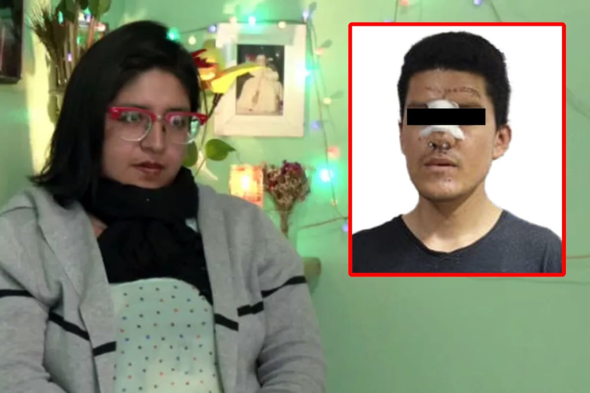 Intentó quemarla viva: detienen a su novio por tentativa de feminicidio contra Arely Escobar, después de un año prófugo