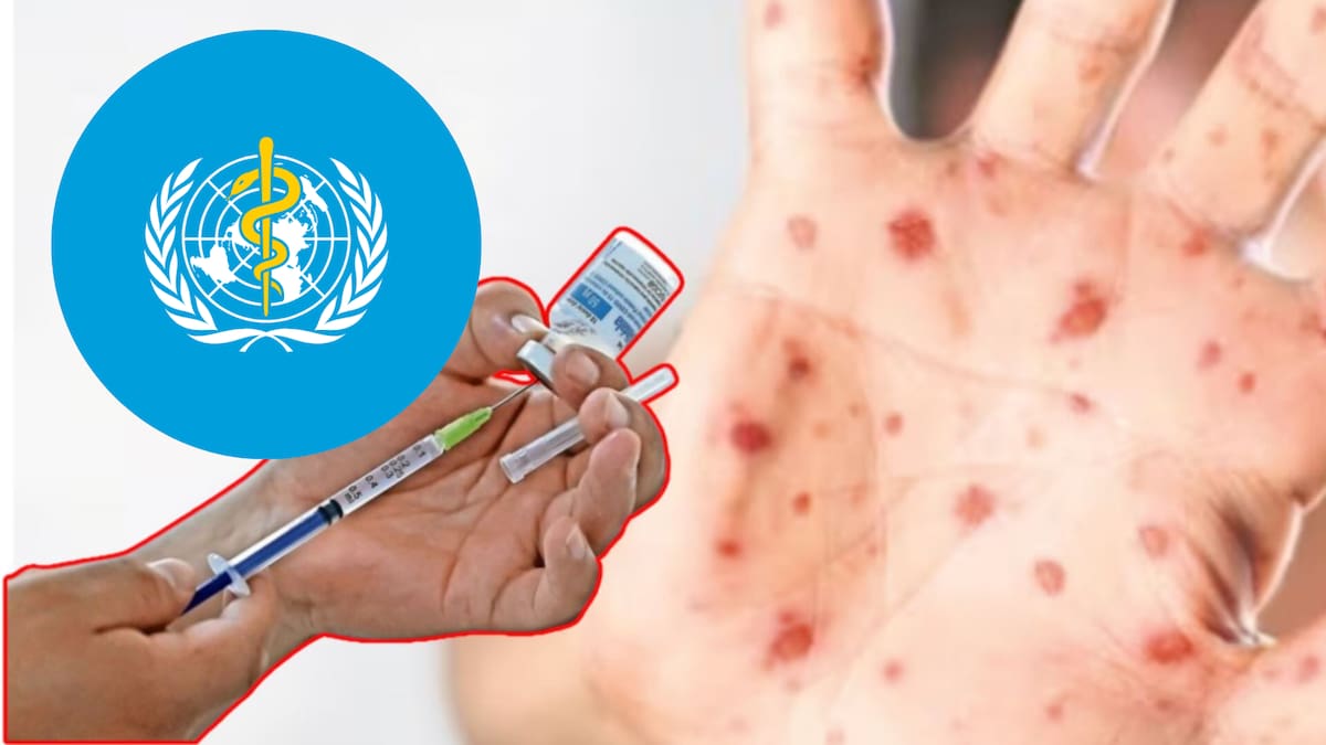 México está en riesgo de perder la certificación de país libre de sarampión de la OMS, tras registrar más de 6 mil 700 casos y mantener brotes activos, autoridades de Salud alistan refuerzos de vacunación y nuevas campañas