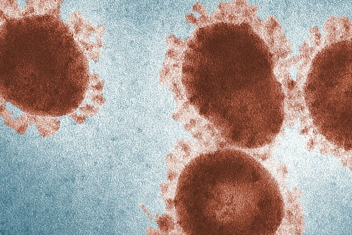 Norovirus repunta en EEUU: Aumentan los casos y alertan por inicio de temporada invernal