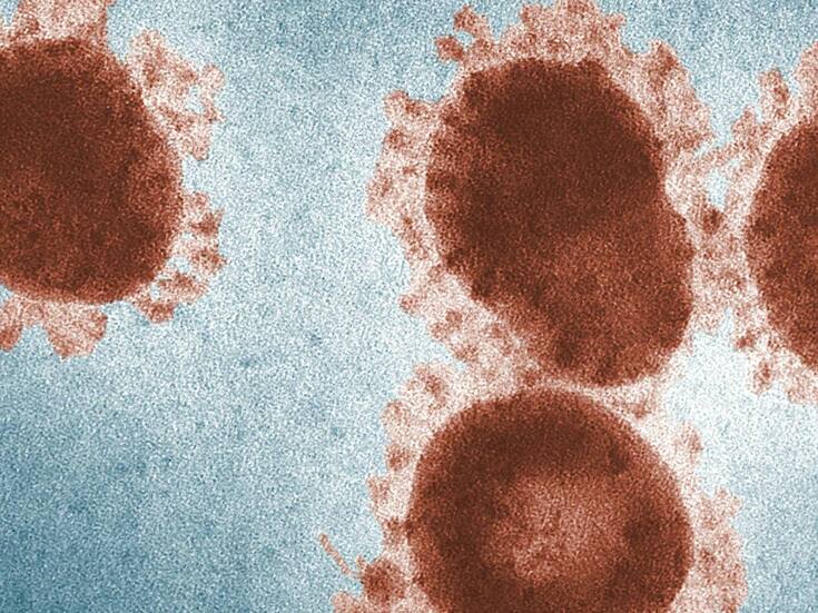 Norovirus repunta en EEUU: Aumentan los casos y alertan por inicio de temporada invernal