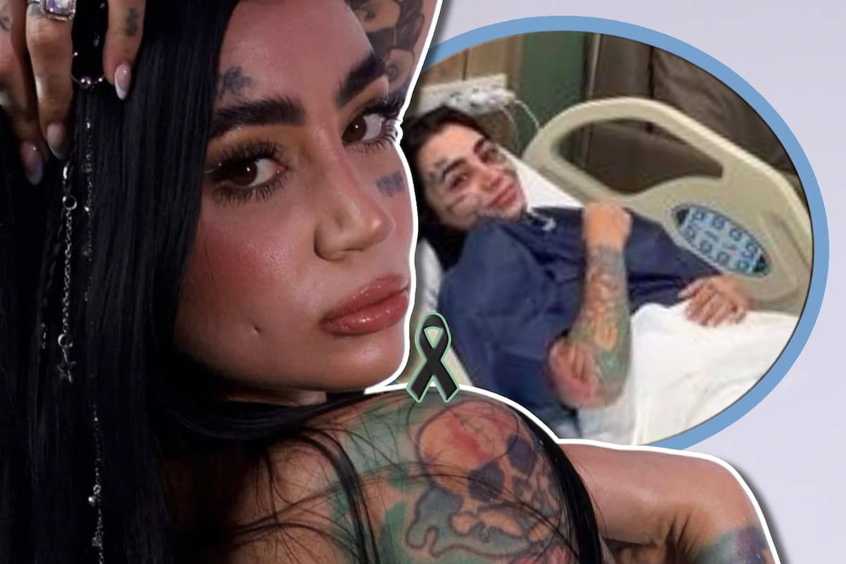 ¿Quién era Ana B? Influencer que murió tras cirugía estética en Turquía; consumió alcohol antes del procedimiento