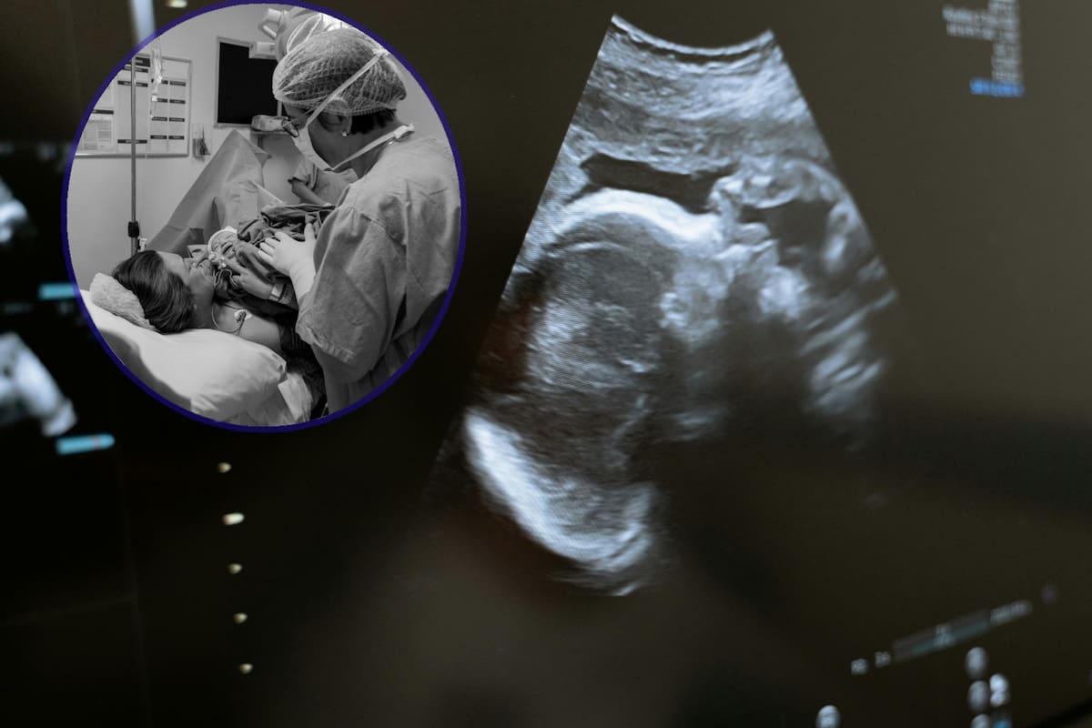 Médicos piden despenalizar el aborto en Puebla y frenar aumento de muertes