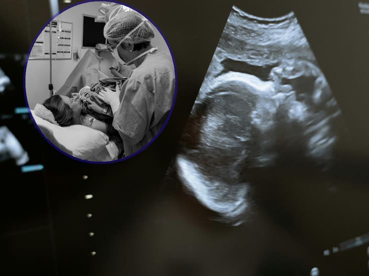 En Wyoming, EEUU prohíben el aborto por “latido fetal” y lo promulgan por una ley, ¿qué significa?