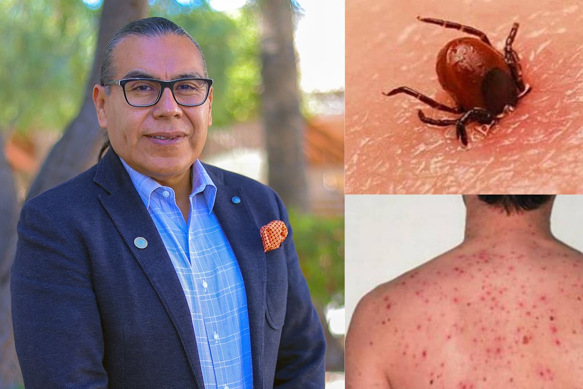 En Sonora mueren cuatro de cada 10 que contraen rickettsia