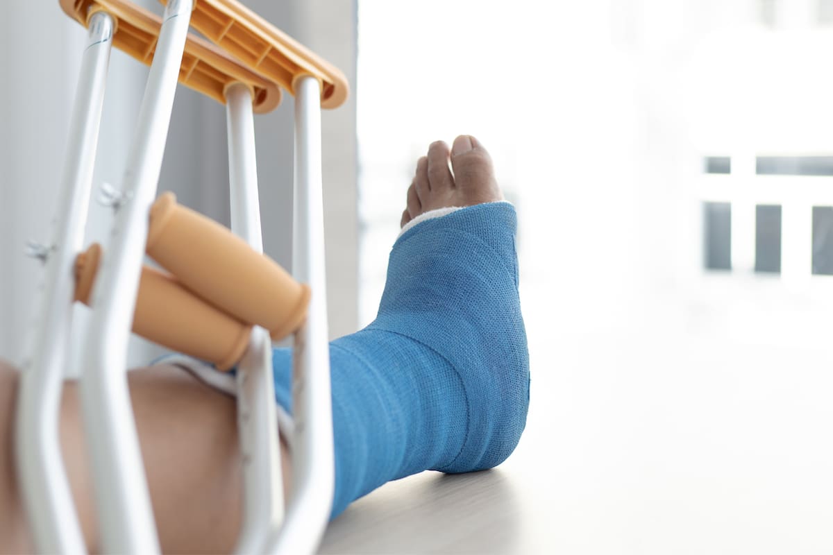 ¿Por qué algunas personas se fracturan más los huesos que otras? Esto dice la ciencia