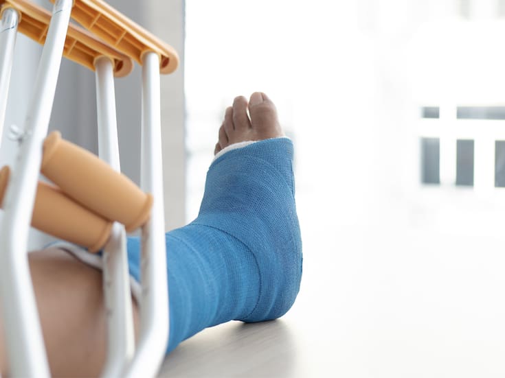 ¿Por qué algunas personas se fracturan más los huesos que otras? Esto dice la ciencia