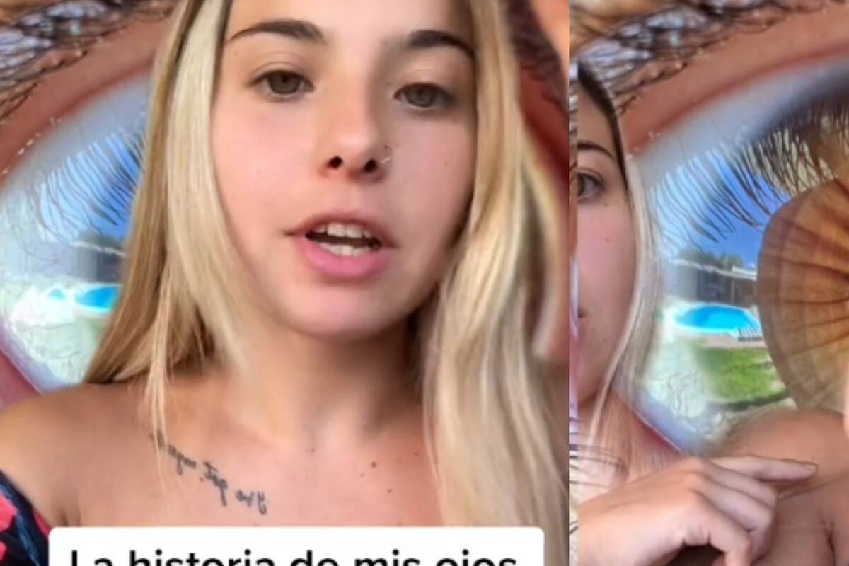 “Parecen de anime”: Tiktoker cuenta la historia detrás de sus ojos peculiares