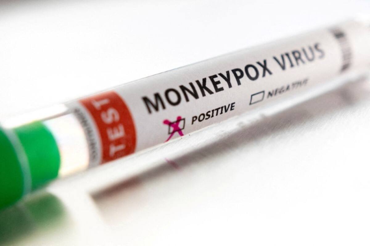 FOTO DE ARCHIVO: Un tubo de ensayo etiquetado como "virus de la viruela del mono positivo" se ve en esta ilustración tomada el 22 de mayo de 2022. REUTERS/Dado Ruvic