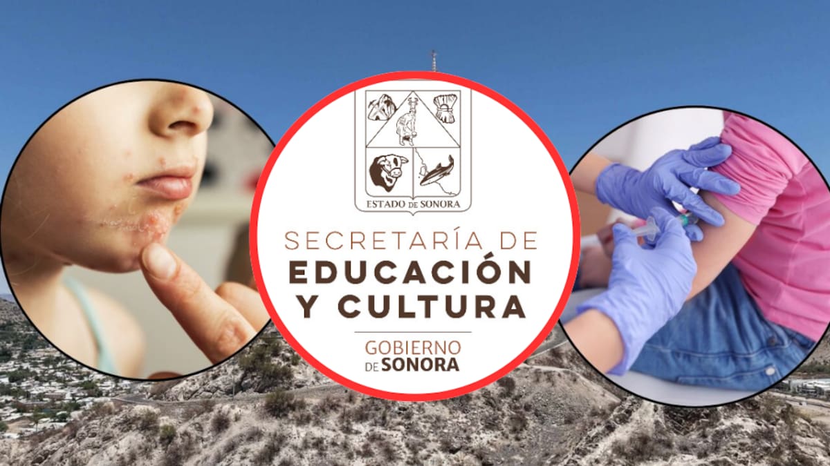 SEC aclara situación por brote de varicela en la Secundaria Técnica 72 de Hermosillo y mantiene clases normales