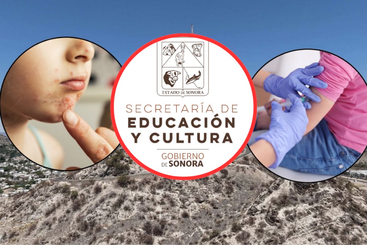 SEC aclara situación por brote de varicela en la Secundaria Técnica 72 y mantiene clases normales