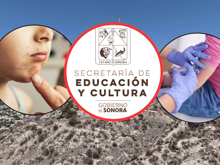 SEC aclara situación por brote de varicela en la Secundaria Técnica 72 y mantiene clases normales