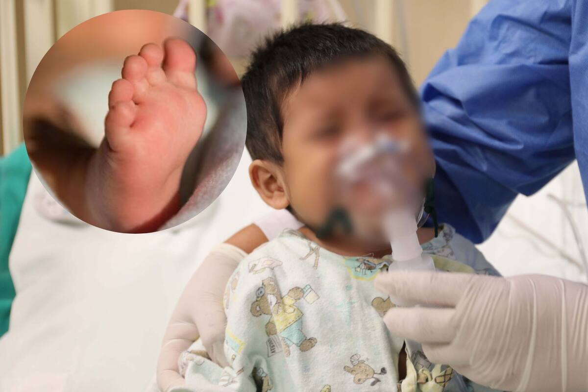 Niños menores de 3 años, la mayoría de hospitalizados por Covid-19 en CDMX: Sedesa