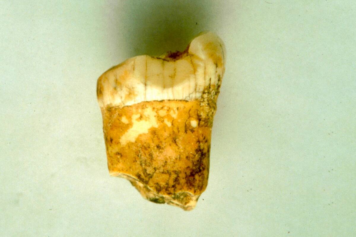 Diente muestra nuevos detalles sobre la alimentación de los neandertales