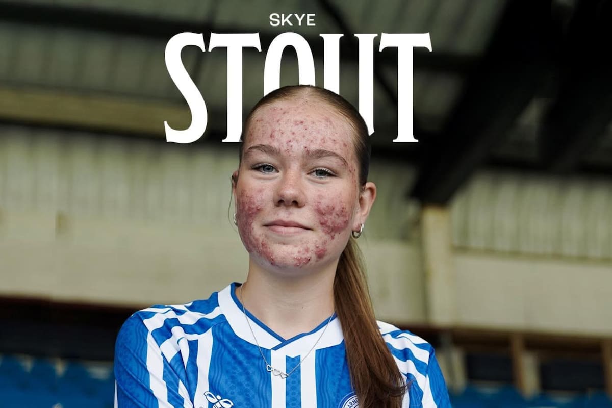 Skye Stout, futbolista de 16 años, firmó un contrato profesional pero terminó siendo acosada por su acné en redes
