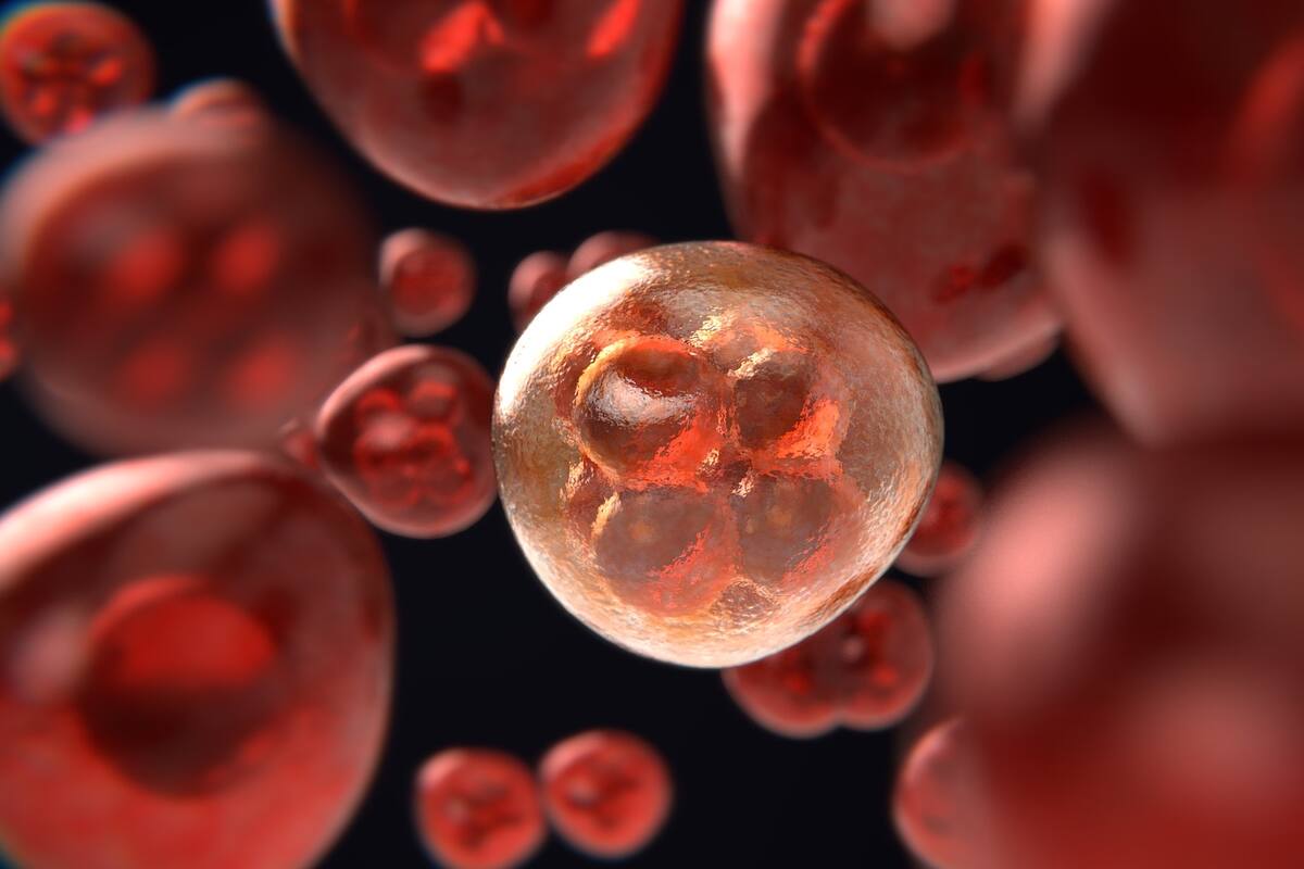 Encuentran un nuevo gen clave para el crecimento del cáncer de colon