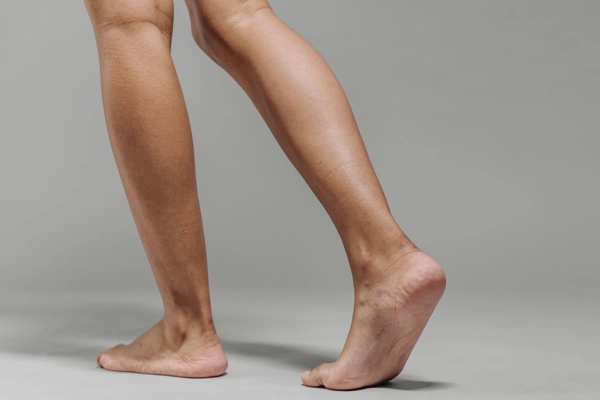 ¿Qué es el lipedema? Trastorno crónico que afecta a las mujeres y cómo tratarlo