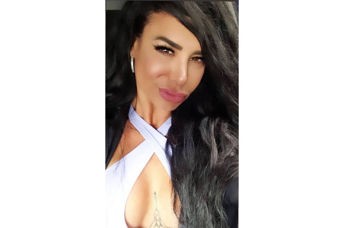Responde Lis Vega a críticas sobre su rostro