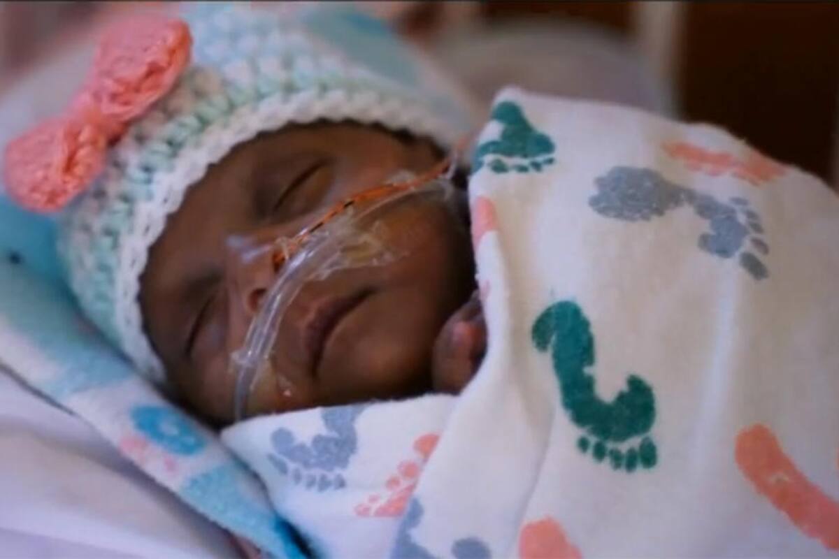 Dan de alta a la bebé más pequeña del mundo nacida en San Diego