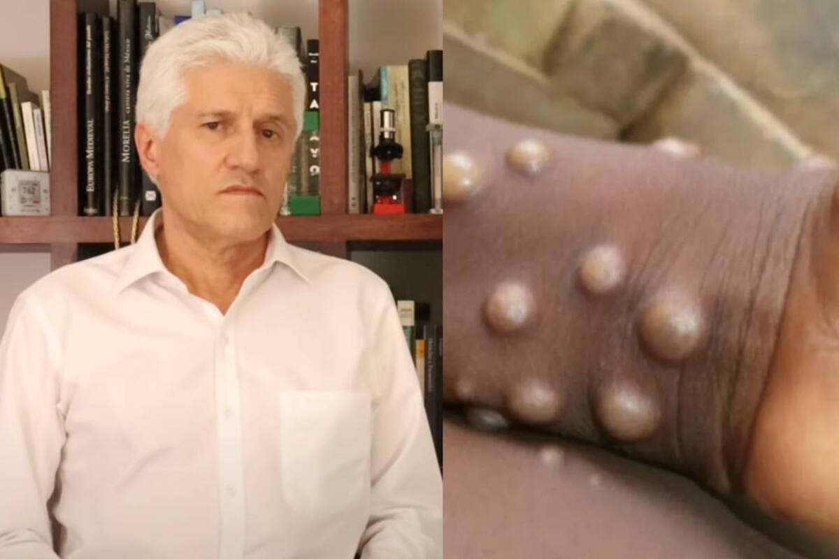 Viruela del mono: Dr. Macías asocia enfermedad con fiesta LGBT de 80 mil personas
