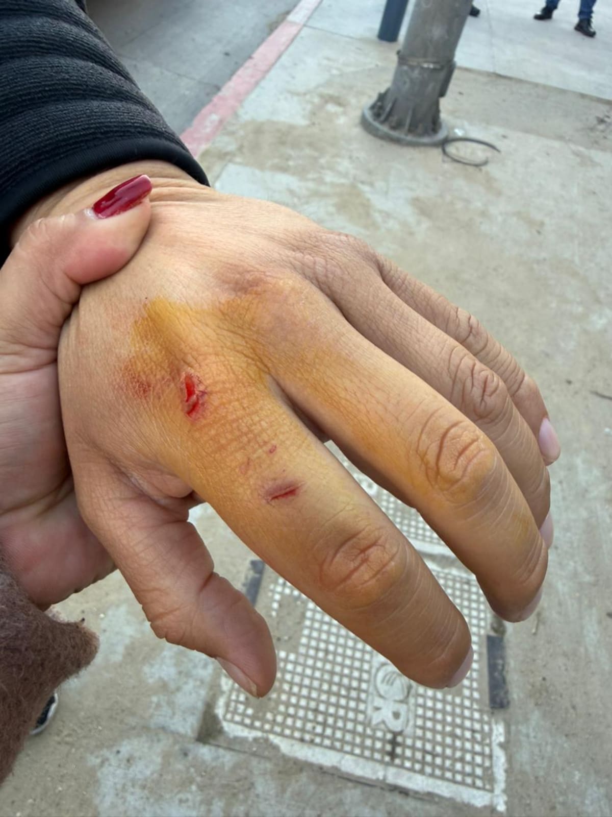 Un chófer de transporte por aplicación fue detenido por la Policía Municipal luego de defenderse de un asalto con arma blanca entre las calles Segunda y Mar Amarillo, mientras uno de los presuntos agresores logró escapar. Foto: Cortesia