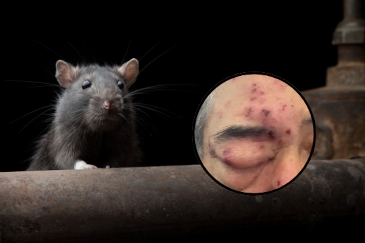 Hombre denuncia plaga de ratas en su edificio; asegura que despertó con con roedores mordiéndole la cara