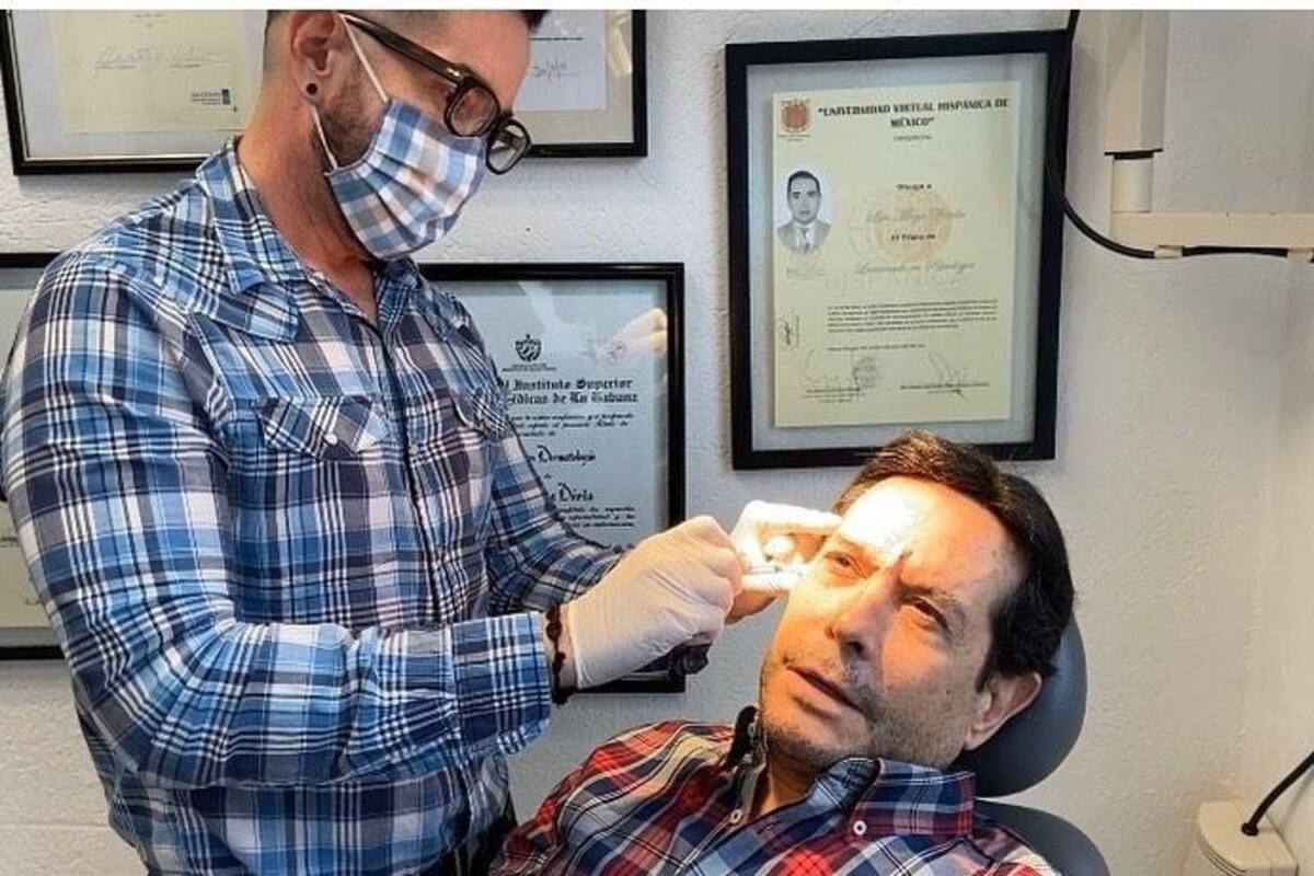 Juan José Origel comparte su experiencia con el botox