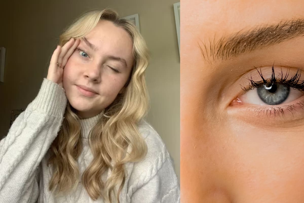 Joven británica enfrenta rara enfermedad que impide abrir sus ojos