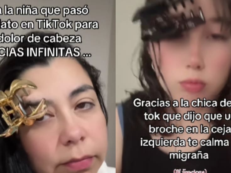 Este es el inusual tip que están utilizando todos en Tiktok para quitar la migraña: ¿Por que funciona?
