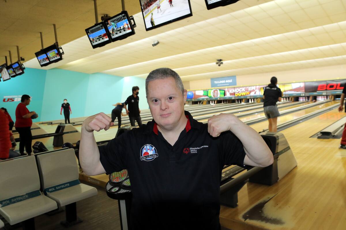 Muchas personas creen que el Síndrome de Down es un peligro al nacer o que la esperanza de vida se acorta; sin embargo los avances médicos demuestran lo contrario.