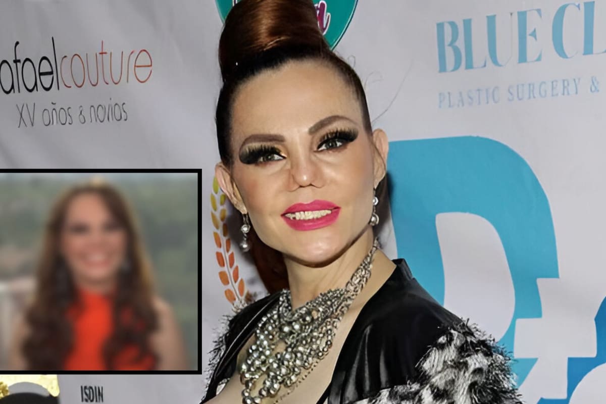 Así luce Carmen Campuzano tras someterse a nueva cirugía de reconstrucción de nariz