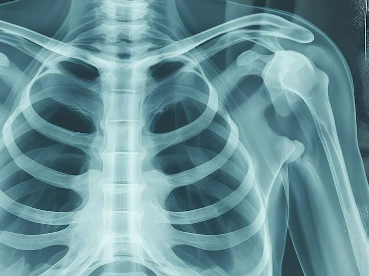 Día Mundial de la EPOC: señales, riesgos y la importancia de actuar a tiempo