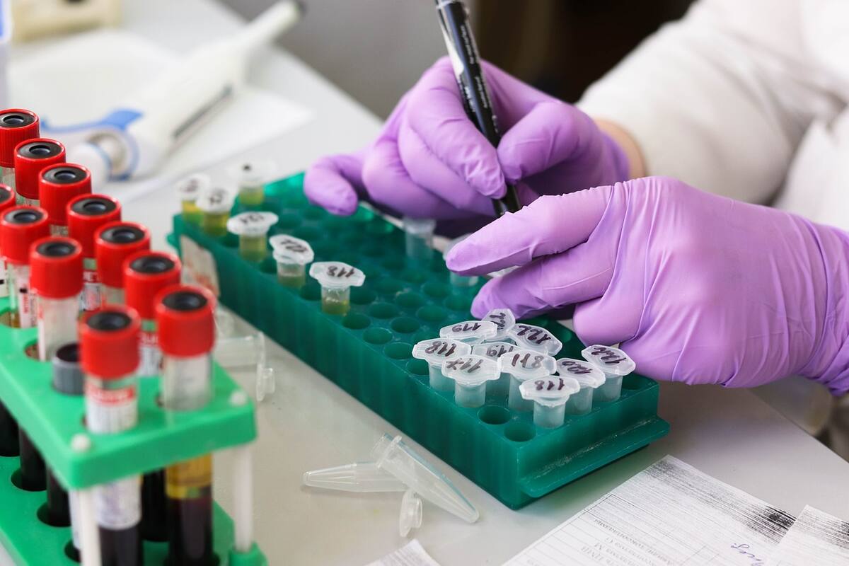 Trabaja IMSS medicina contra el VIH