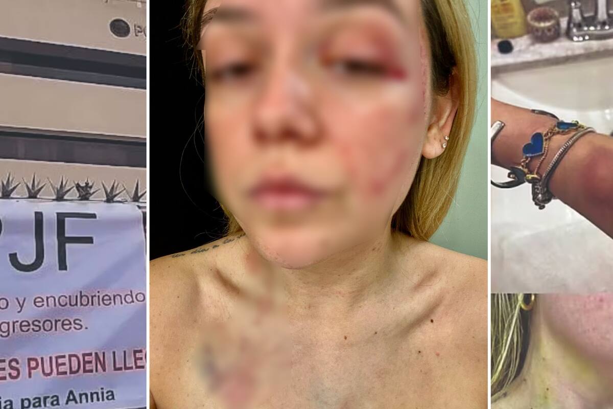 Fiscalía detalla caso Annia por violencia familiar