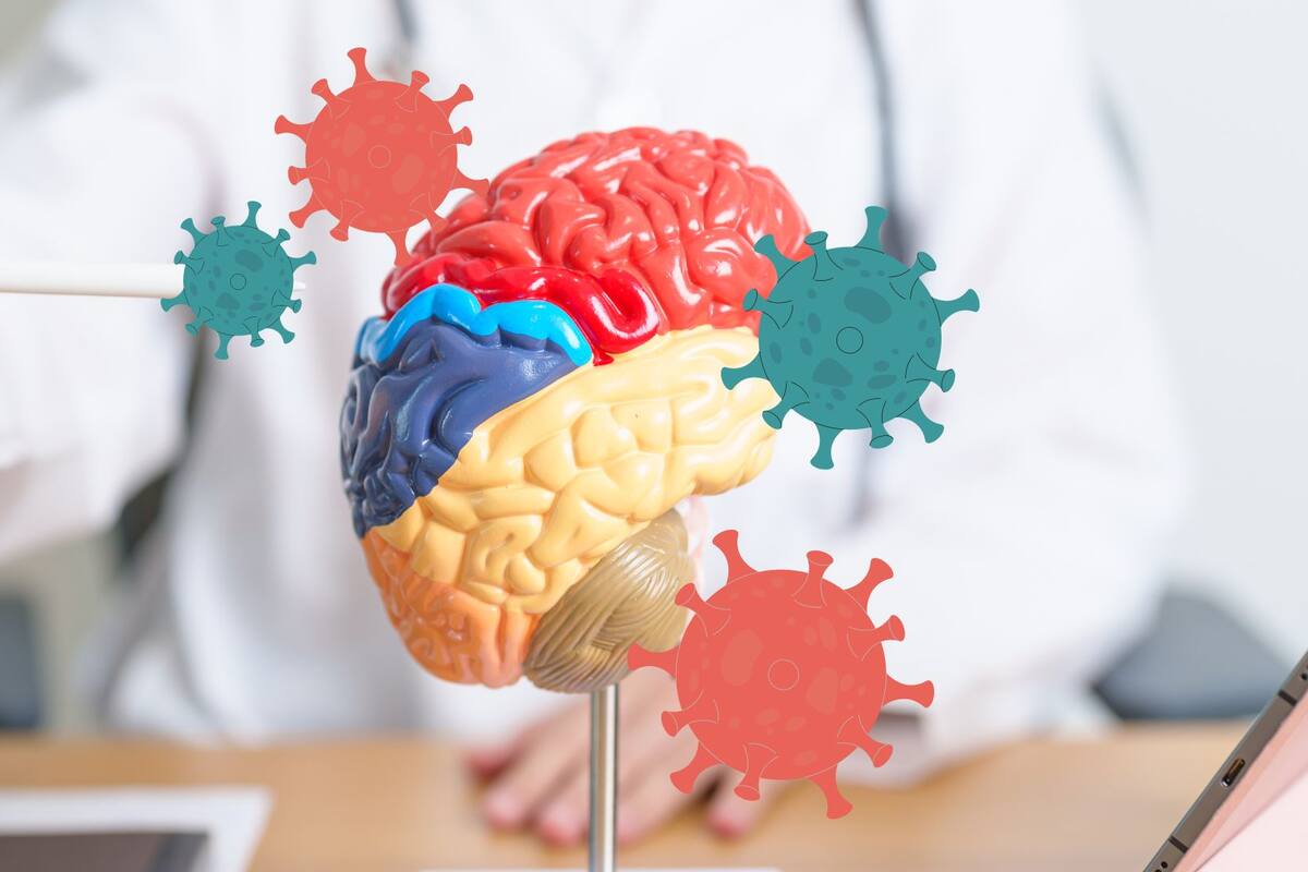 Investigaciones demuestran como el COVID-19 deja marcas en el cerebro