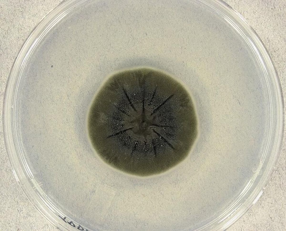 Cladosporium sphaerospermum. Foto: Wikimedia Commons