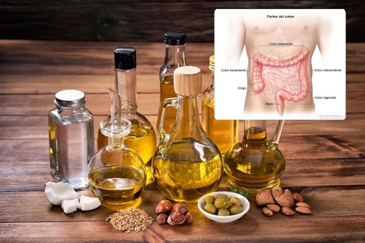 Hay una relación entre el aceite de cocina y el aumento del cáncer de colon, ¿lo sabías?