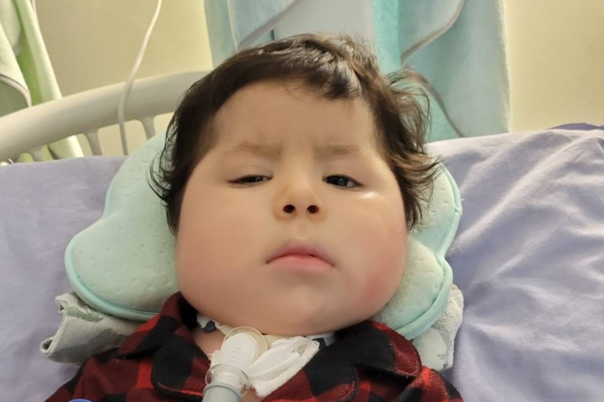 Familia solicita donativo para Rafita, un bebé de 1 año con atrofia muscular