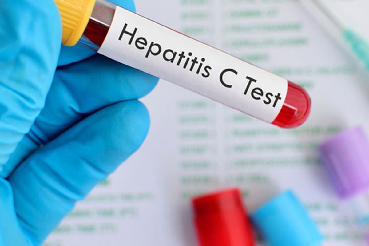 Causan hepatitis B y C 65% de los casos de cáncer de hígado