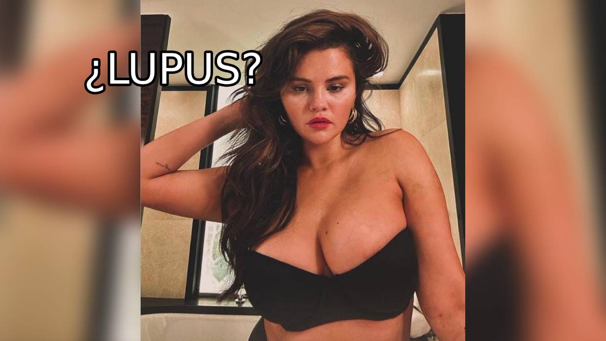 ¿El lupus y su tratamiento realmente han repercutido en el busto de Selena Gomez?