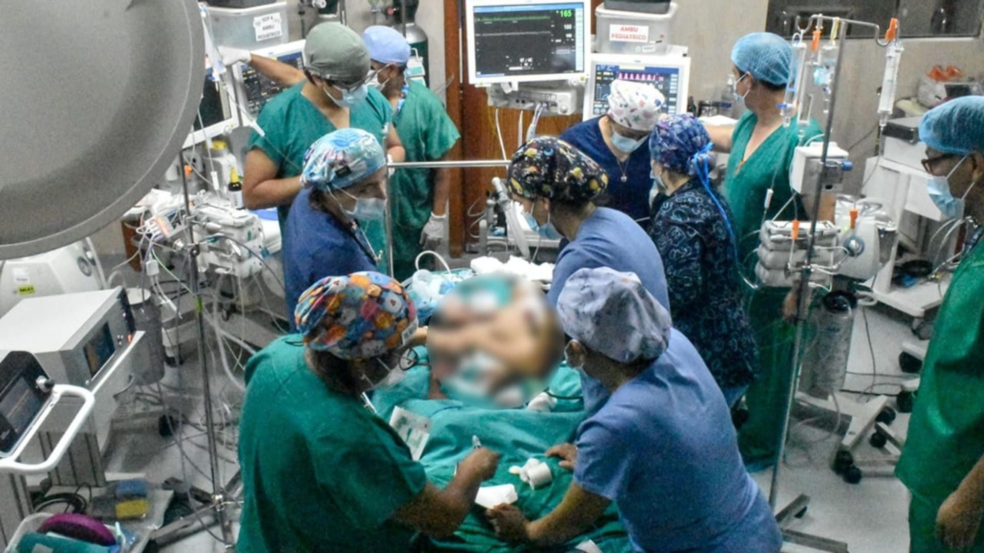 Fotografía cedida hoy por el Ministerio de Salud (Minsa) del Perú que muestra la operación a dos gemelos siameses en el Hospital San Bartolomé de Lima (Perú). EFE/Minsa
