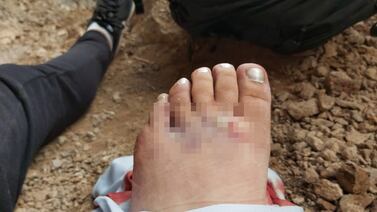 Cajemense se accidenta en cerro Tetakawi; sufre varias lesiones y fractura de pie