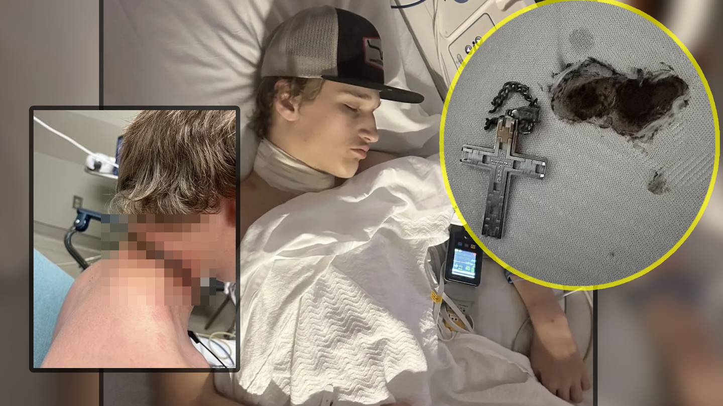 Crucifijo provoca que un adolescente casi muera en un extraño accidente